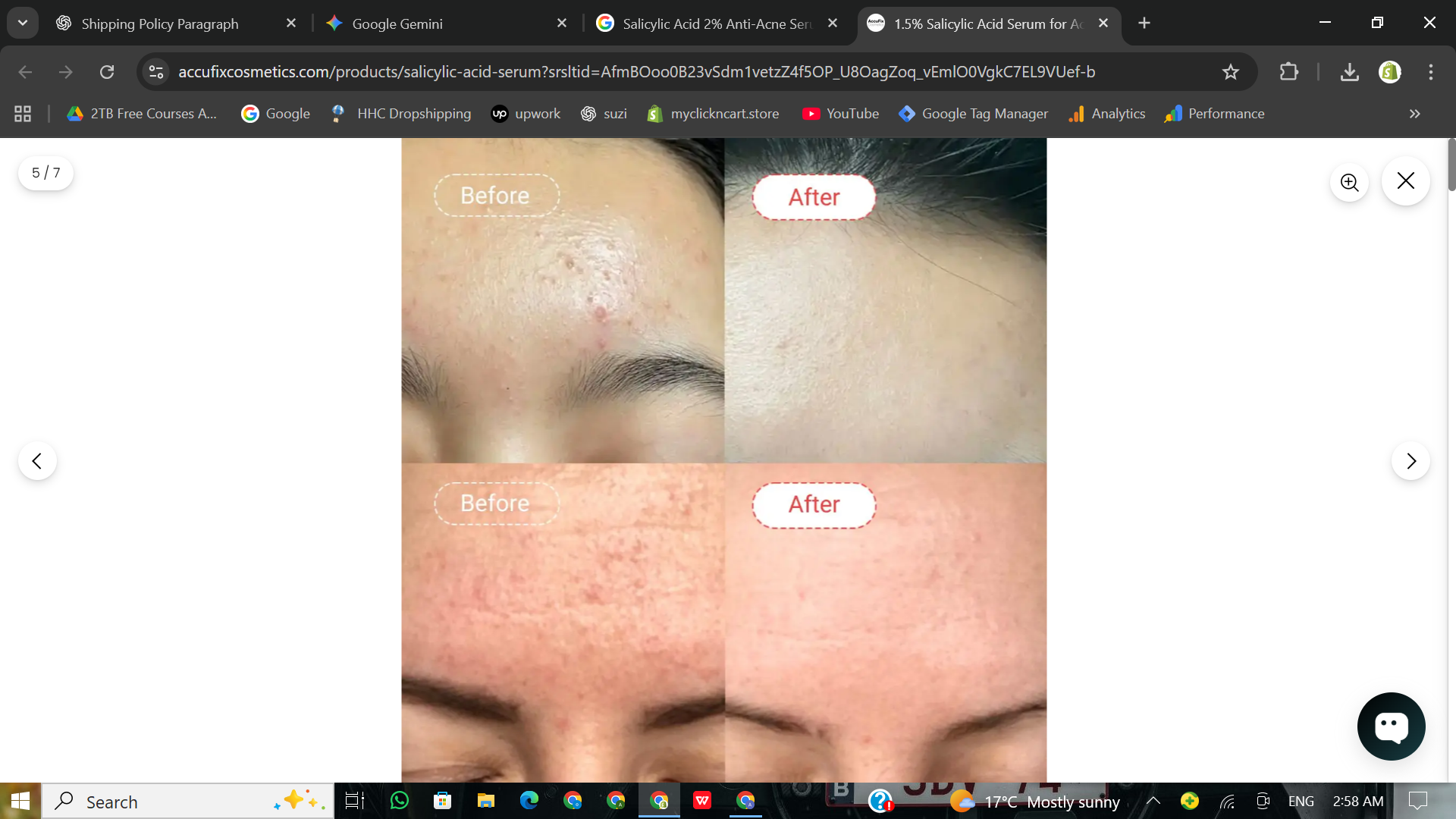 “Salicylic Acid 2% Anti-Acne Serum –